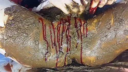 AnnaCoprofield – Shit and Blood Vol 4 – Part 2