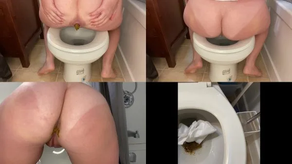 Foxness – POOPING! a series – episode 5